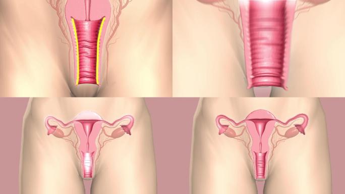 女性妇科妇科疾病子宫阴道弹性