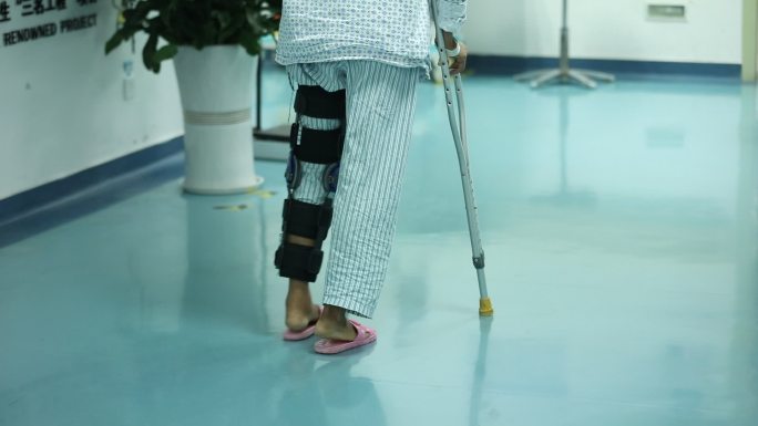 病人骨折扭伤脚