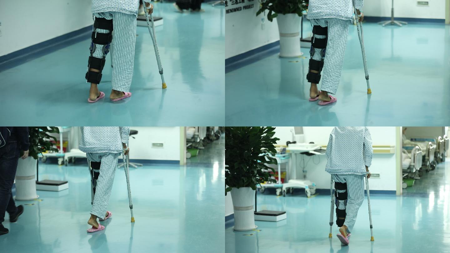 病人骨折扭伤脚