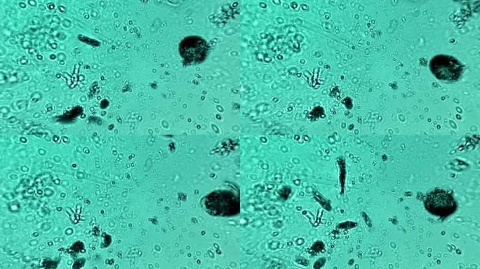 显微镜看细菌微生物蠕动