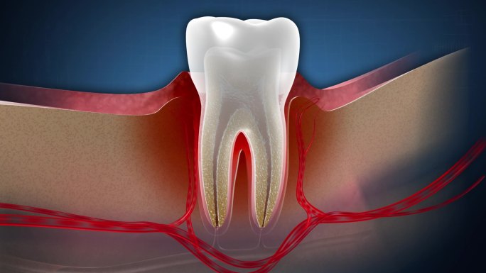 牙龈病变导致牙齿松动甚至脱落