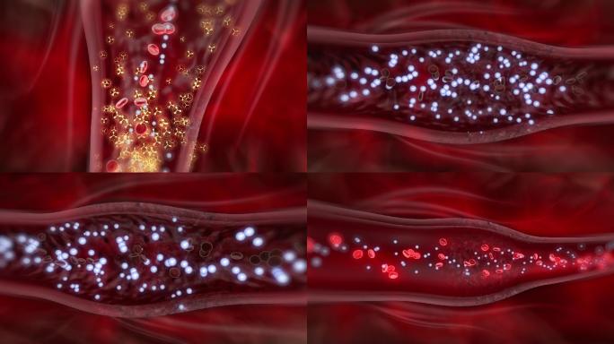 微观展示血管钙离子浓度变化过程对血管影响