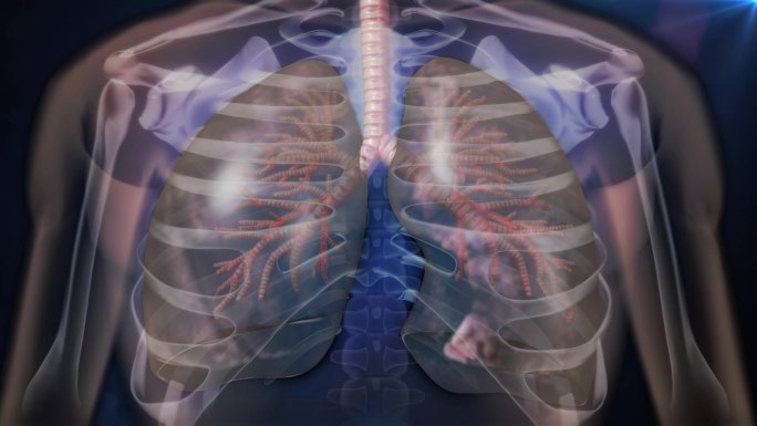 肺气肿病人的肺发炎肿胀无弹性而且不能透气