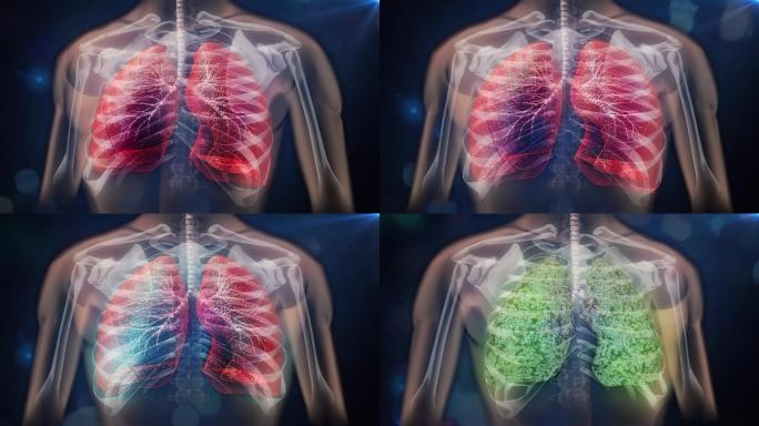 空气污染和病原毒素堆积在肺部导致肺部疾病