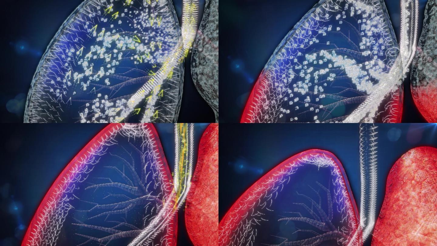 肺动力充足肺部纤毛清扫毒素把毒痰抽出体外