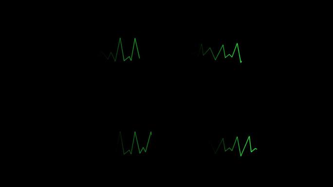 4K心电图走动心电图波动心电图