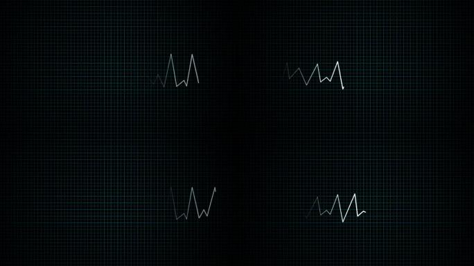 4K心电图走动心电图波动