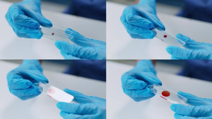 【4K】医生医护人员血液检测检验
