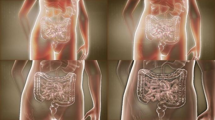 毒素堆积在肠道是肥胖成因之一