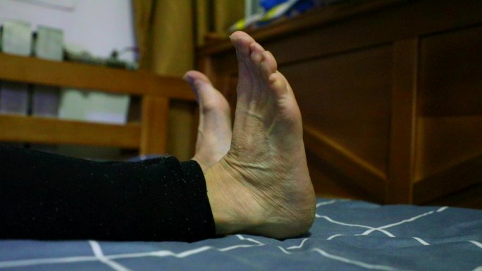 长期卧床防止静脉血栓勾脚运动