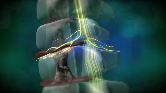 椎间盘、骨刺压迫血管、神经、脊髓各种病变