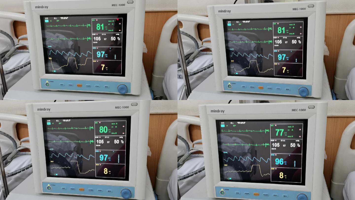 医院术后血压心跳监控器