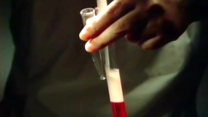 医疗卫生体检抽血验血化验血常规