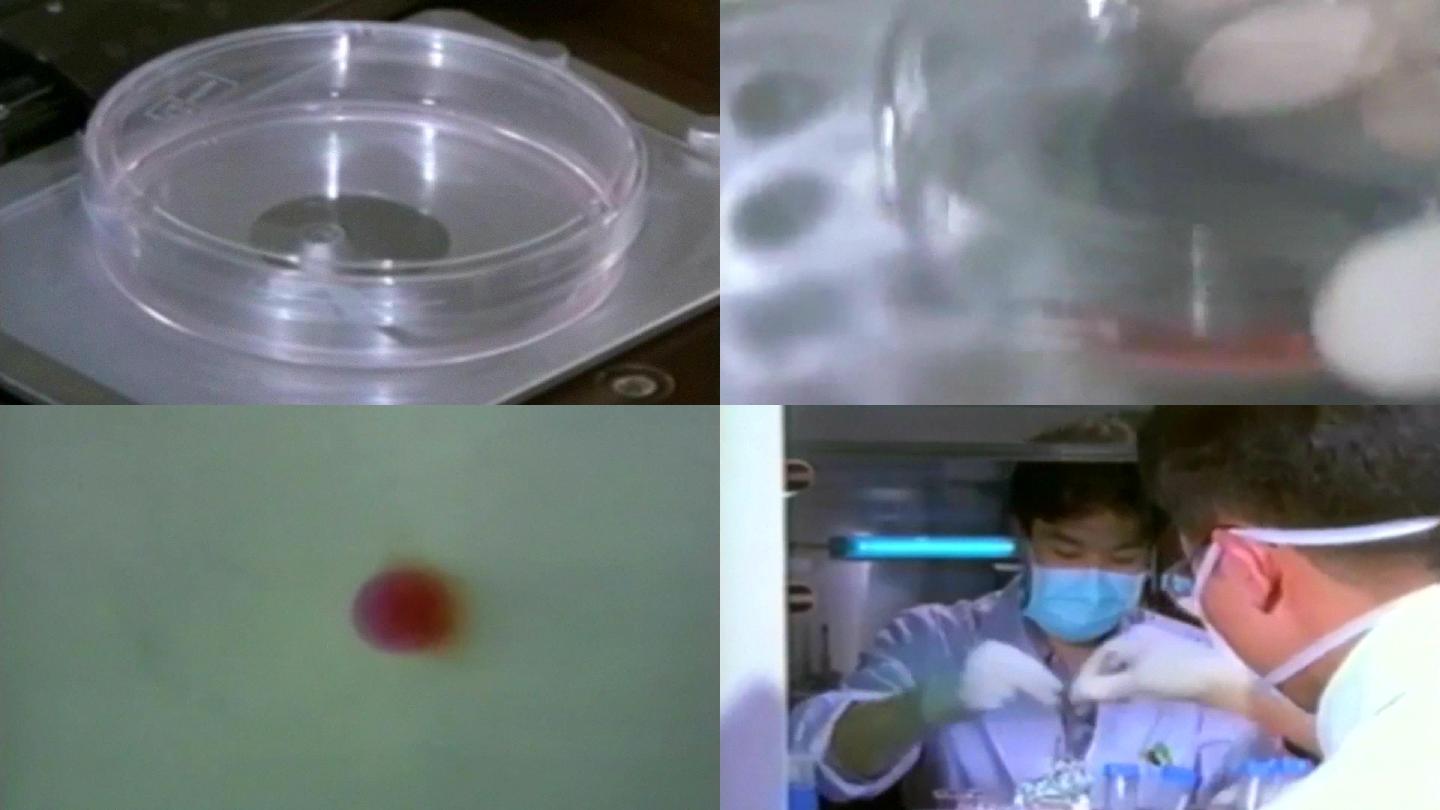 医学新型重组人血管内皮细胞血液血样