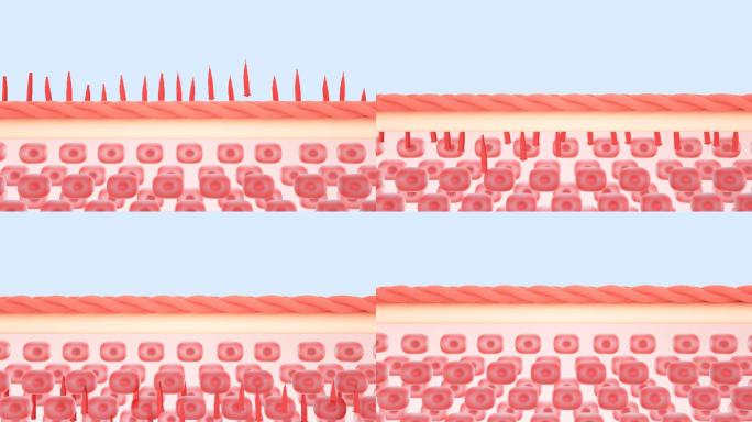【视频】皮肤渗透