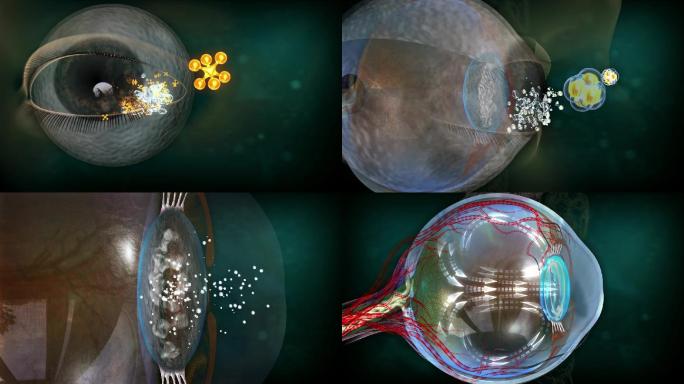 粉剂与泪液结合生成超微离子透入晶状体内