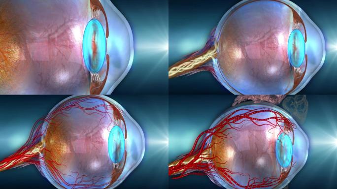 眼球三部分结构晶状体玻璃体视网膜及病变