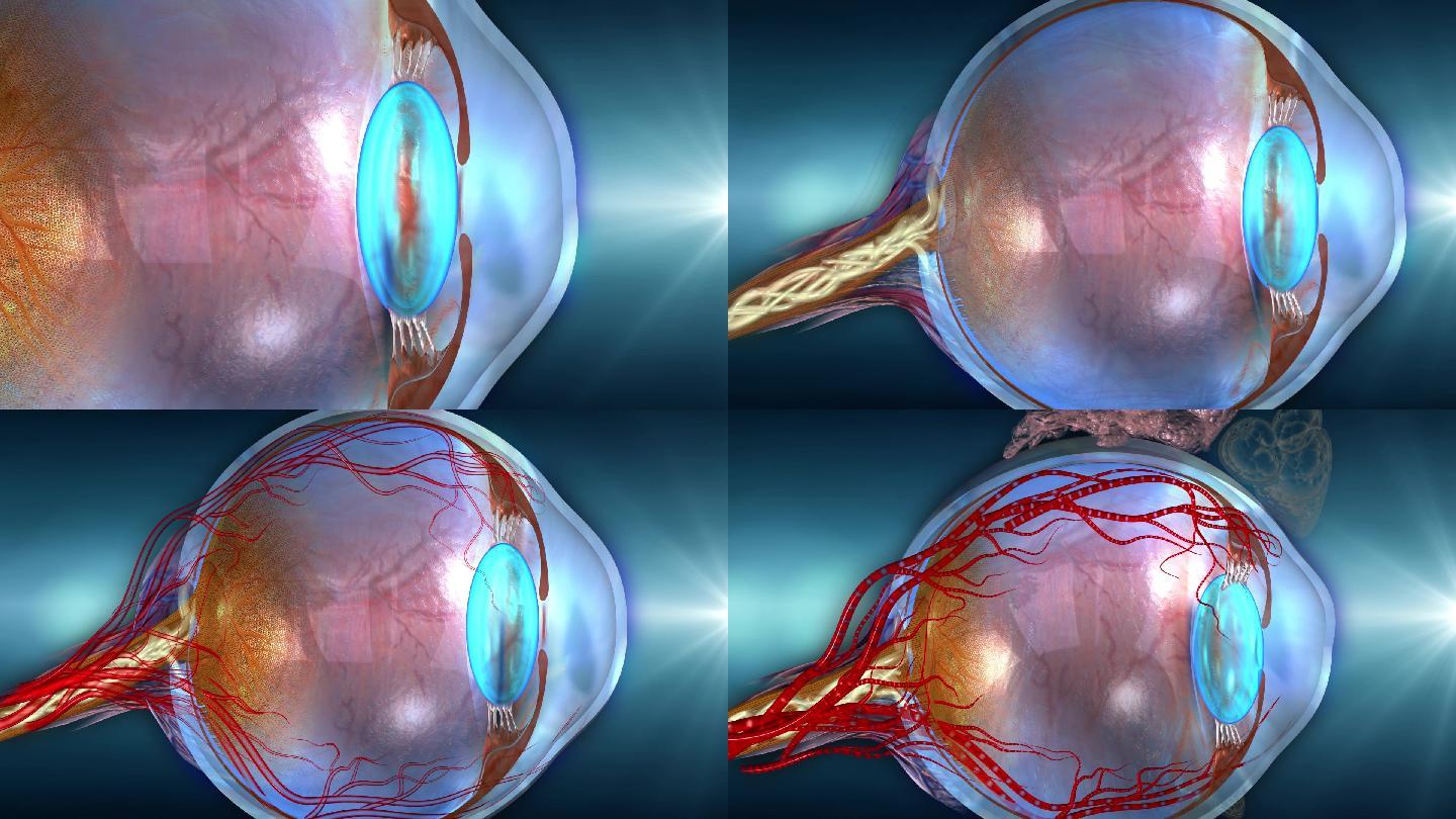 眼球三部分结构晶状体玻璃体视网膜及病变