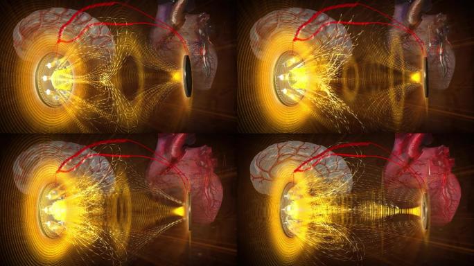 多种磁力能量维护心脑血管康复