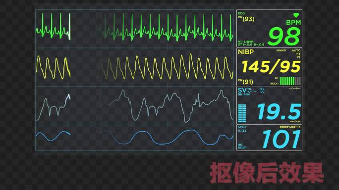 2款心电图动画-黑底