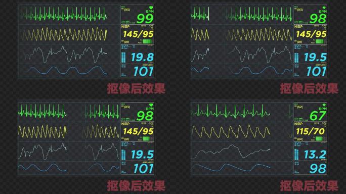2款心电图动画-黑底