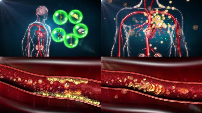 多效降压分子团分解血管脂类沉积毒素、垃圾