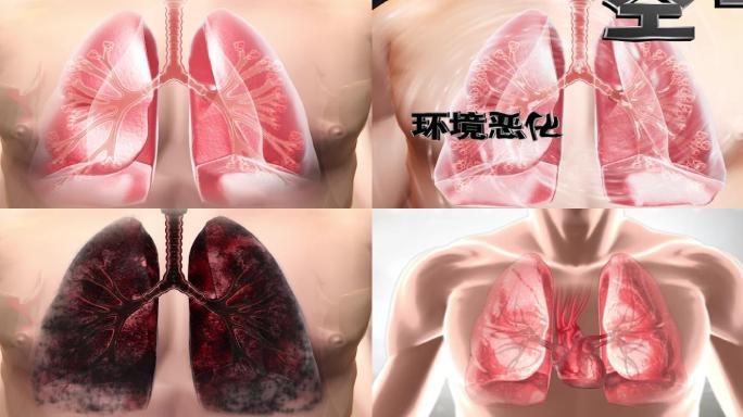 肺肺部呼吸呼吸系统呼吸道肺结核