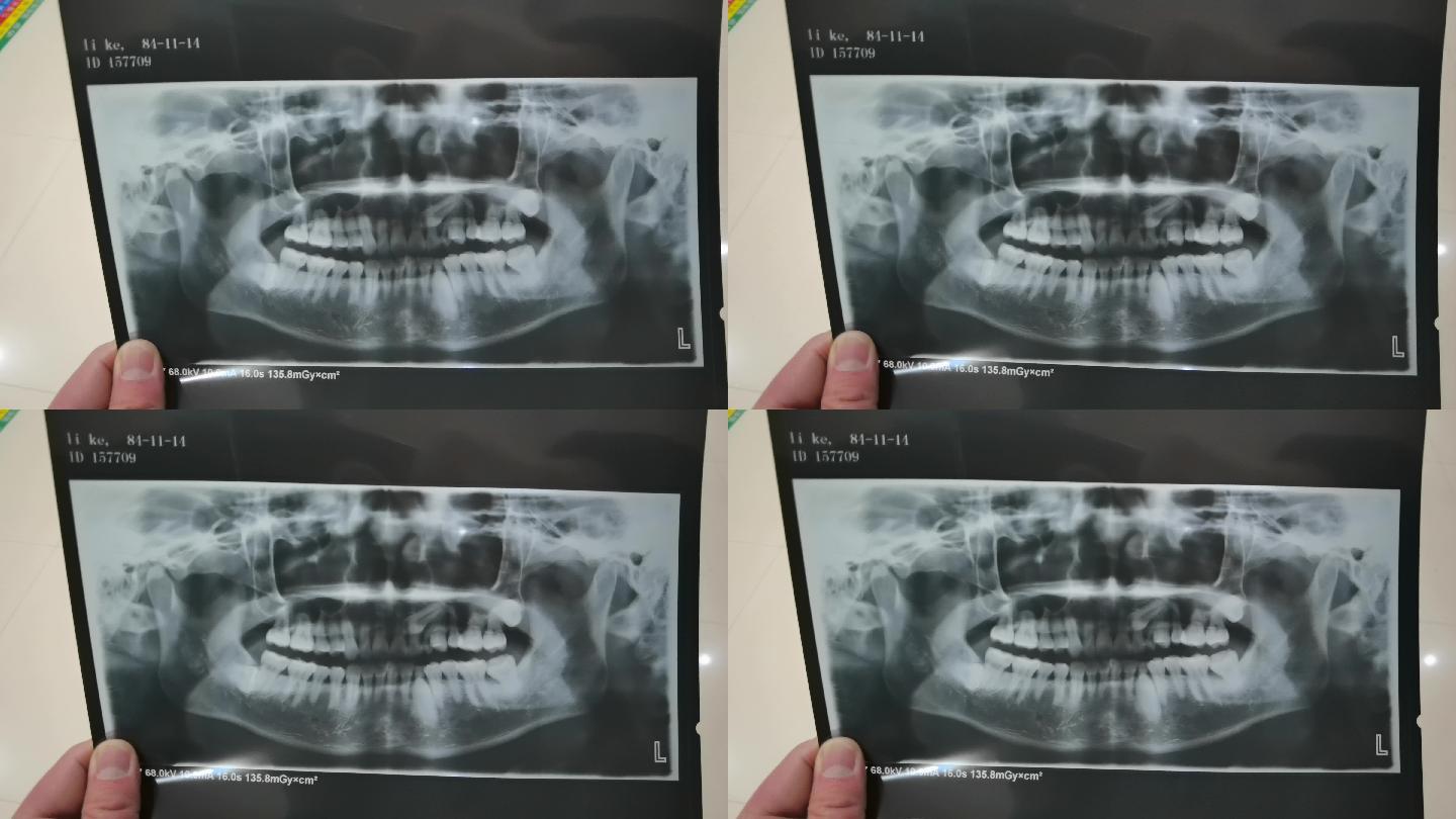 牙科口腔科拍片