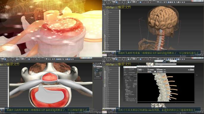 骨科片头脊柱椎间盘+max源文件