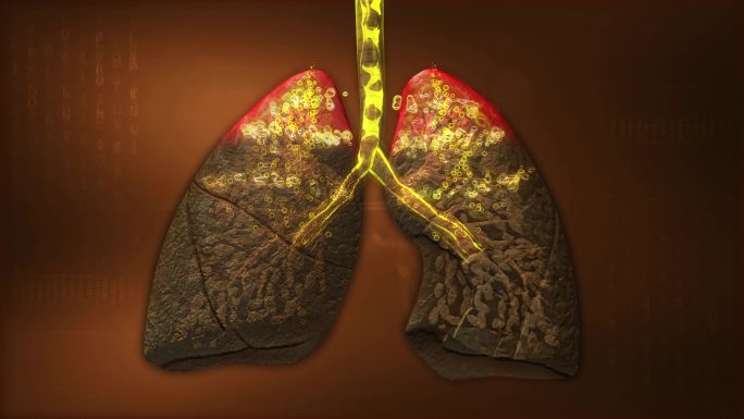中医认为肺液是滋养肺泡、润滑气道的润滑液