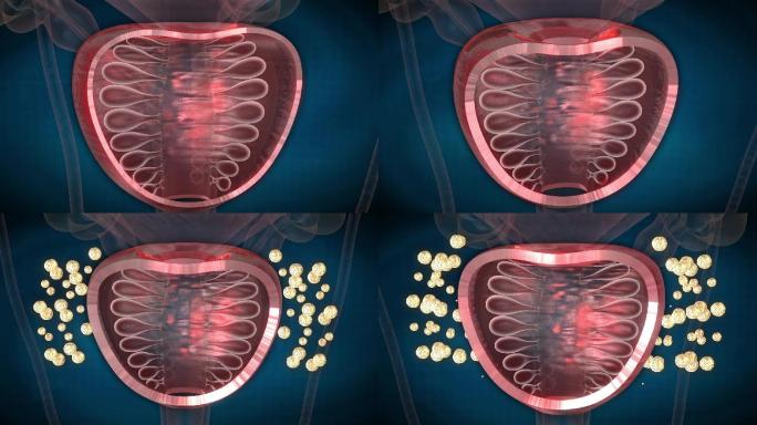 前列腺表层脂质包膜紧密厚实大分子药物难入