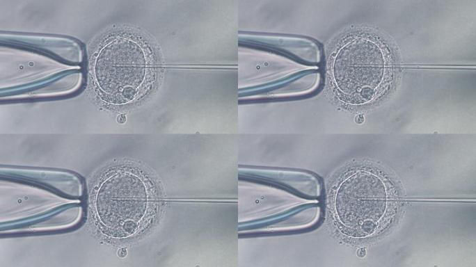 人卵穿刺和精子注射