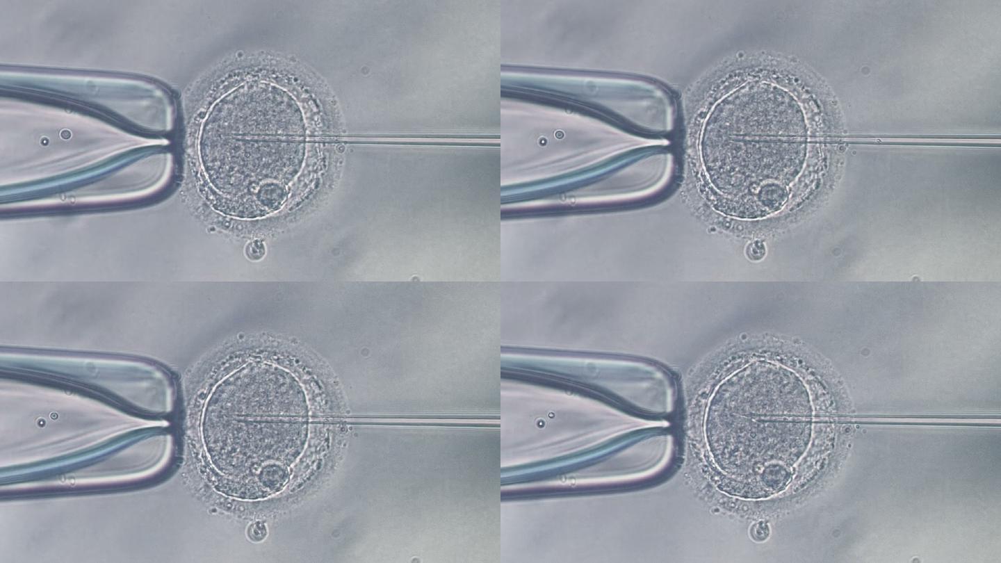 人卵穿刺和精子注射