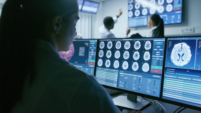 女科学家在电脑上处理脑部CT扫描图像