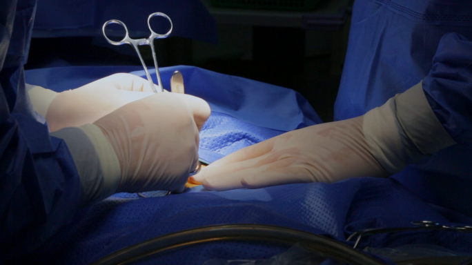 3d腹腔镜手术，微创手术，医院手术
