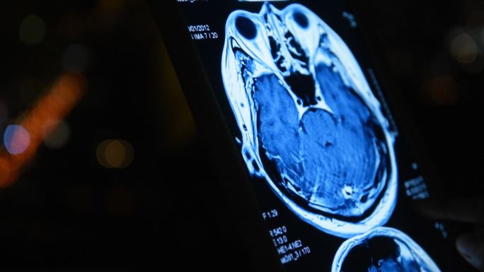 脑部扫描检查超声波干细胞