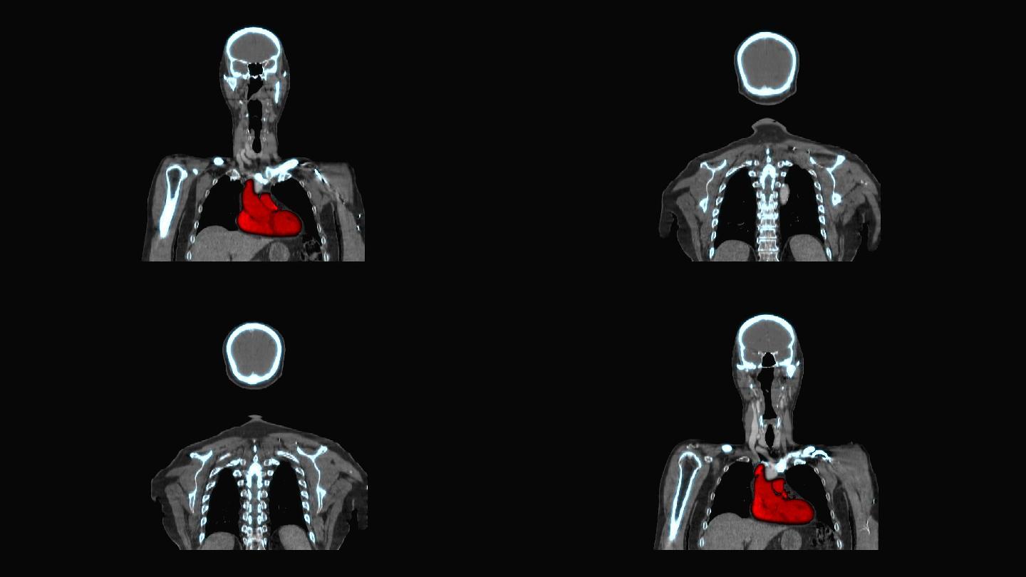医学X射线成像放射学检查