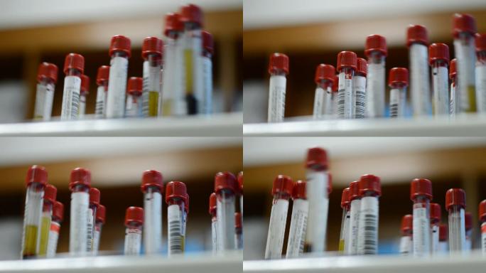离心管血液测试实验室设备分析