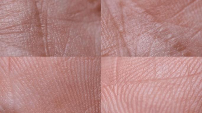 皮肤纹理