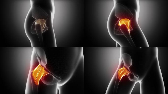 髋关节韧带解剖学负冲效果内窥镜医疗特效动