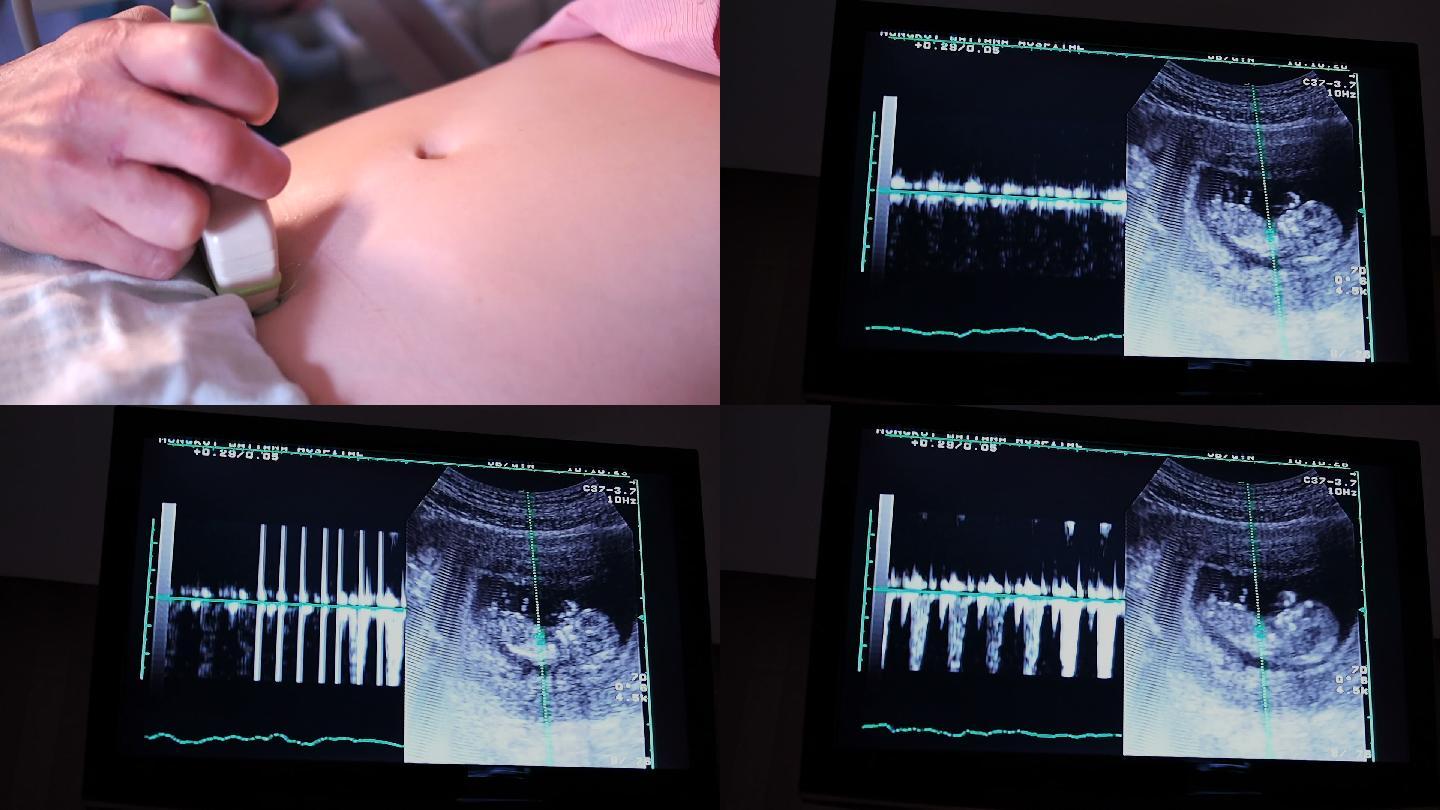 超声波孕妇肚子月子中心胎教母婴孕育怀孕十