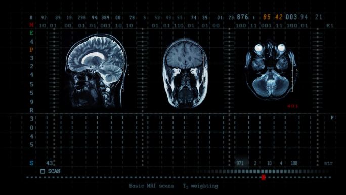 脑MRT扫描CT体检设备