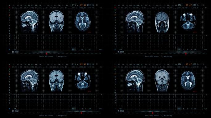 脑MRT扫描CT体检设备