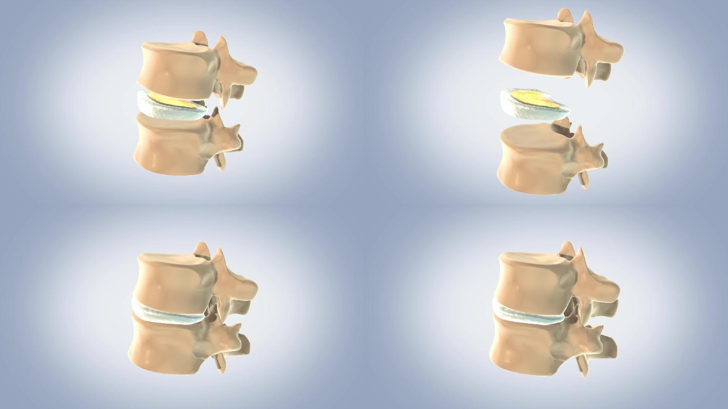 椎间盘作用