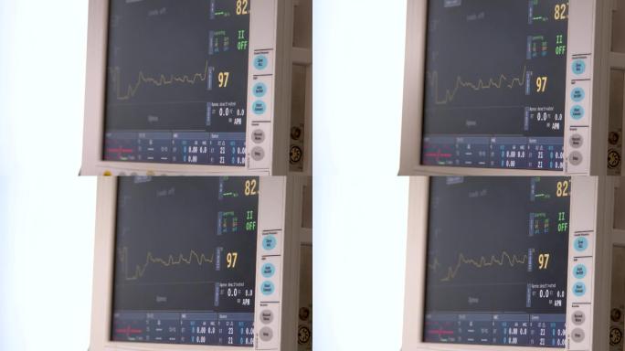 电脑医疗心电图实拍
