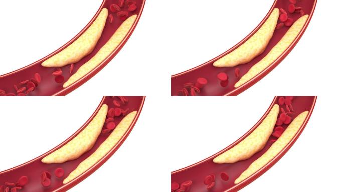 血管中的脂肪与细胞3D渲染