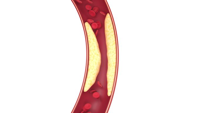 血管中的脂肪与细胞3D渲染