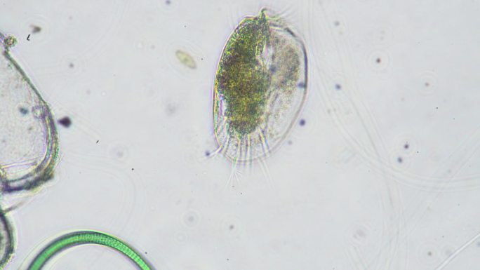 微生物-草履虫科学显微照片草履虫科学