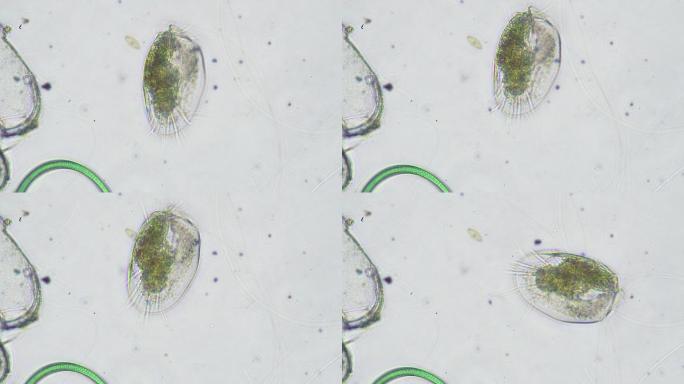 微生物-草履虫科学显微照片草履虫科学