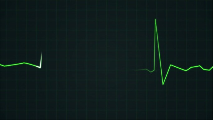 心电图心脏监护仪变平